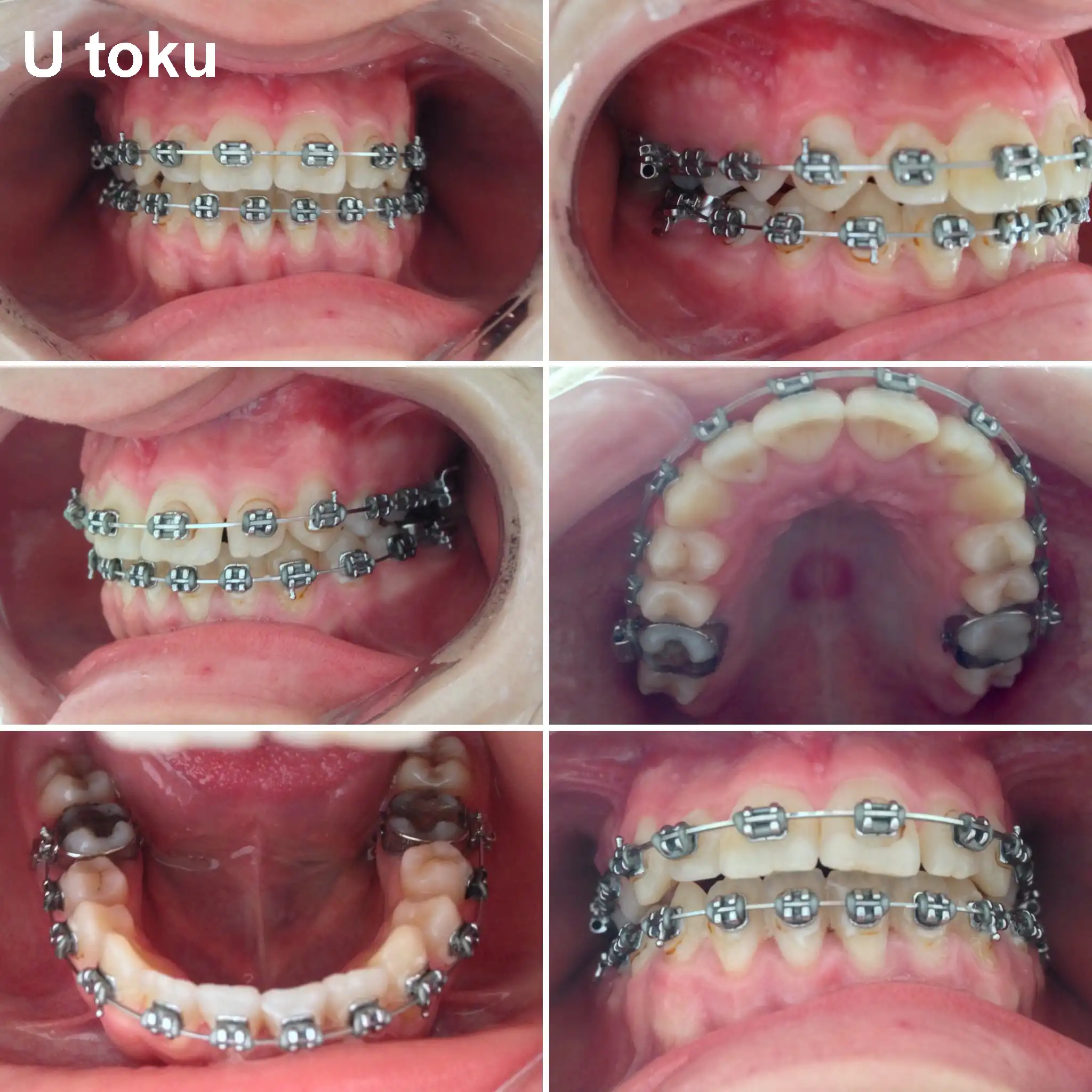 Ortodoncija_1_1bU-toku