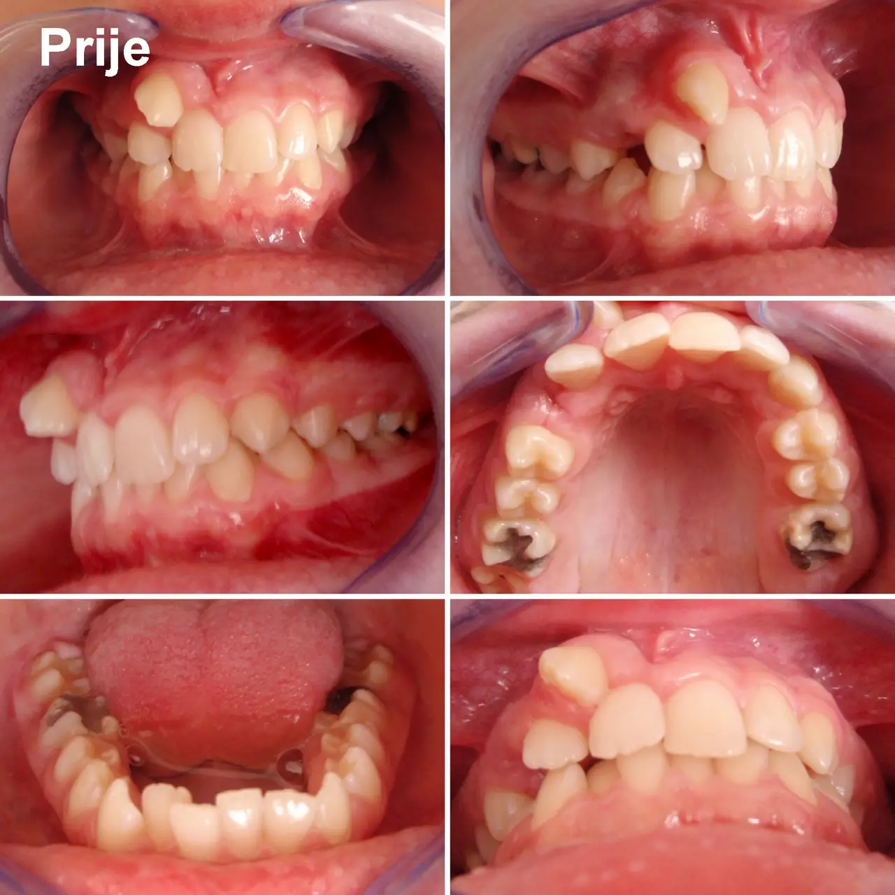 Ortodoncija_5aPrije Large